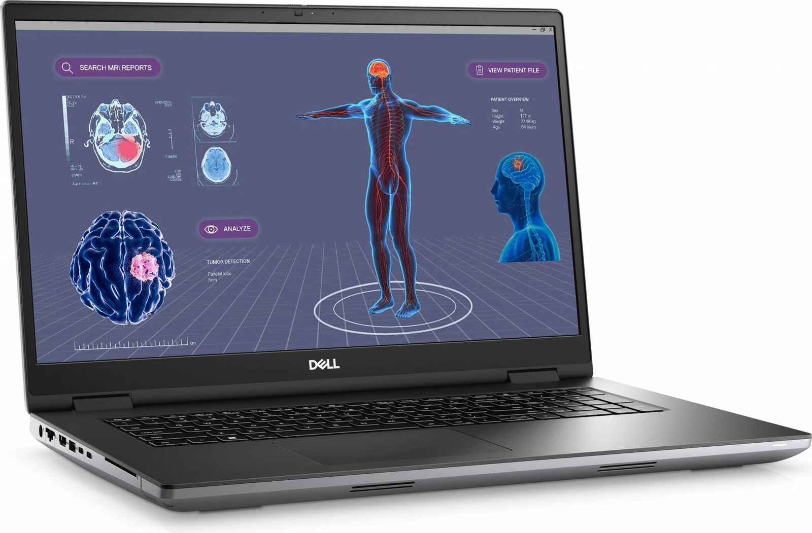 Laptop DELL Precision 7780, Intel Core i7, 32 GB RAM, 1 TB, 17.3", Gri