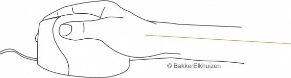 Maus Evoluent Evoluent4, 6 butona, për dorën e djathtë, zi/gri