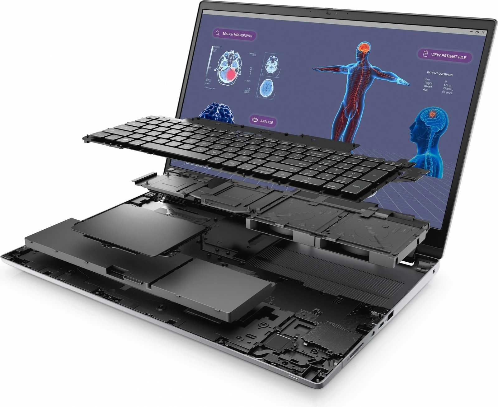 Laptop DELL Precision 7780, Intel Core i7, 32 GB RAM, 1 TB, 17.3", Gri