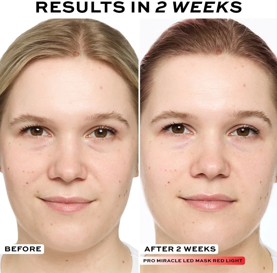 Revolution Pro Miracle LED Face Mask