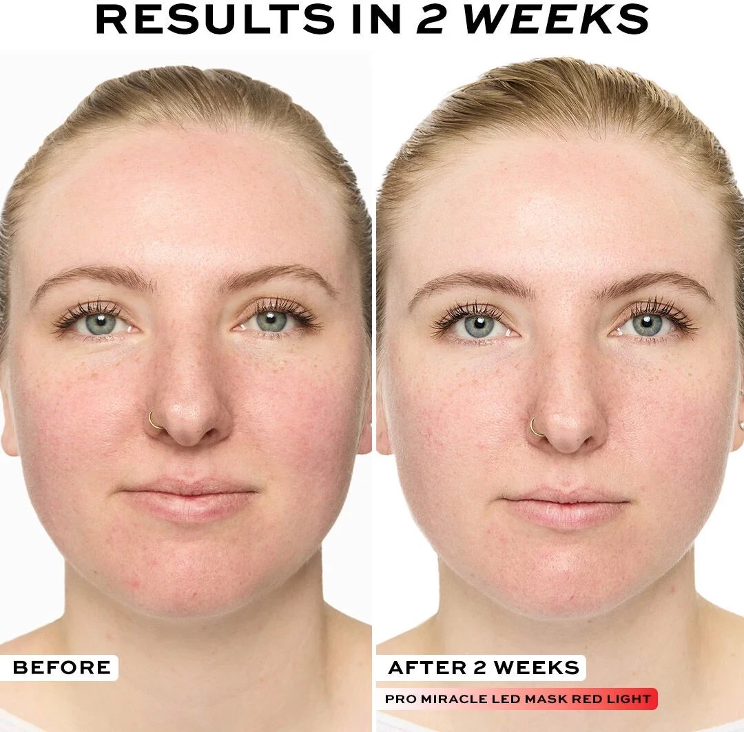 Revolution Pro Miracle LED Face Mask