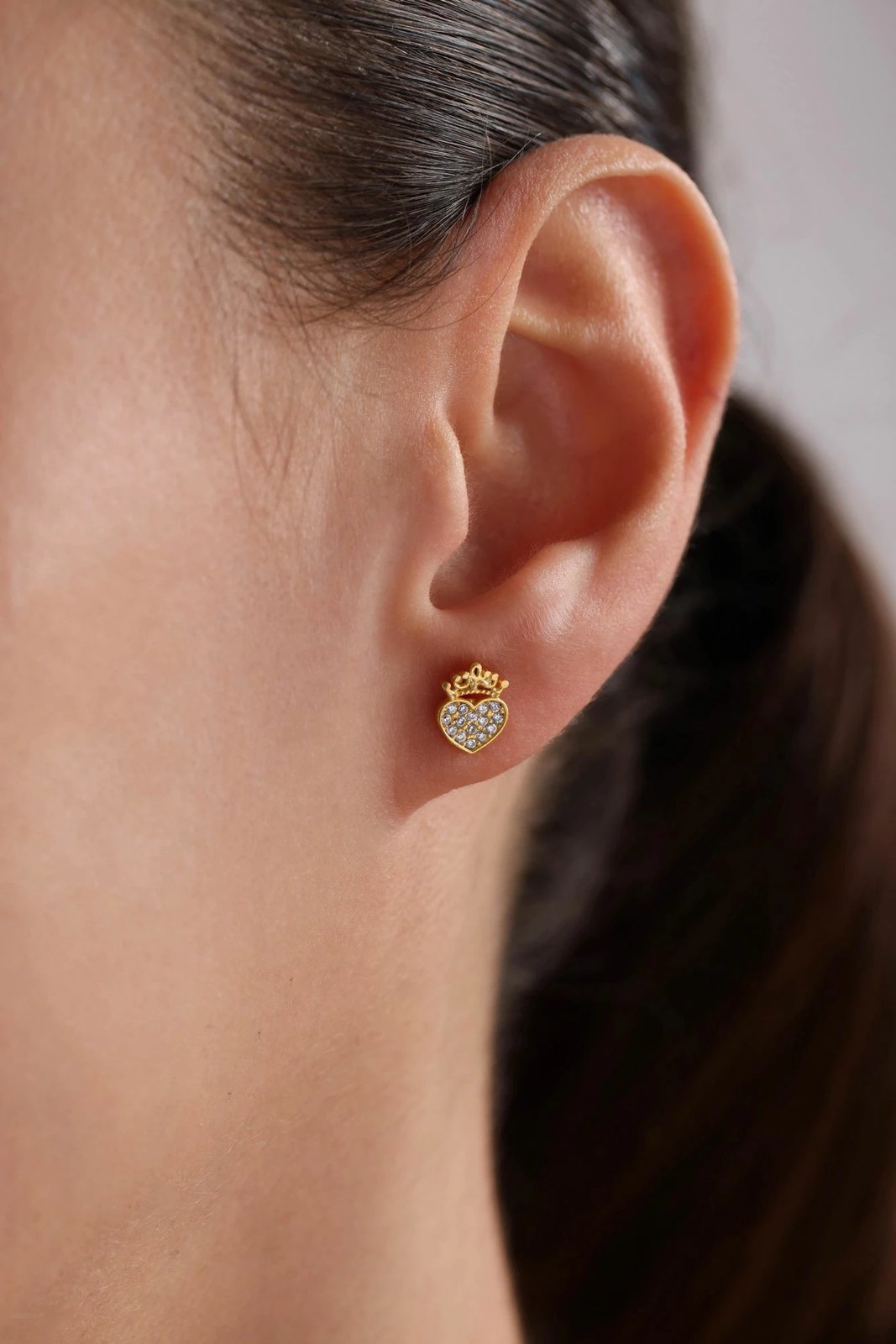 Vathë argjendi të artë, Jumeon, NRZ1000004