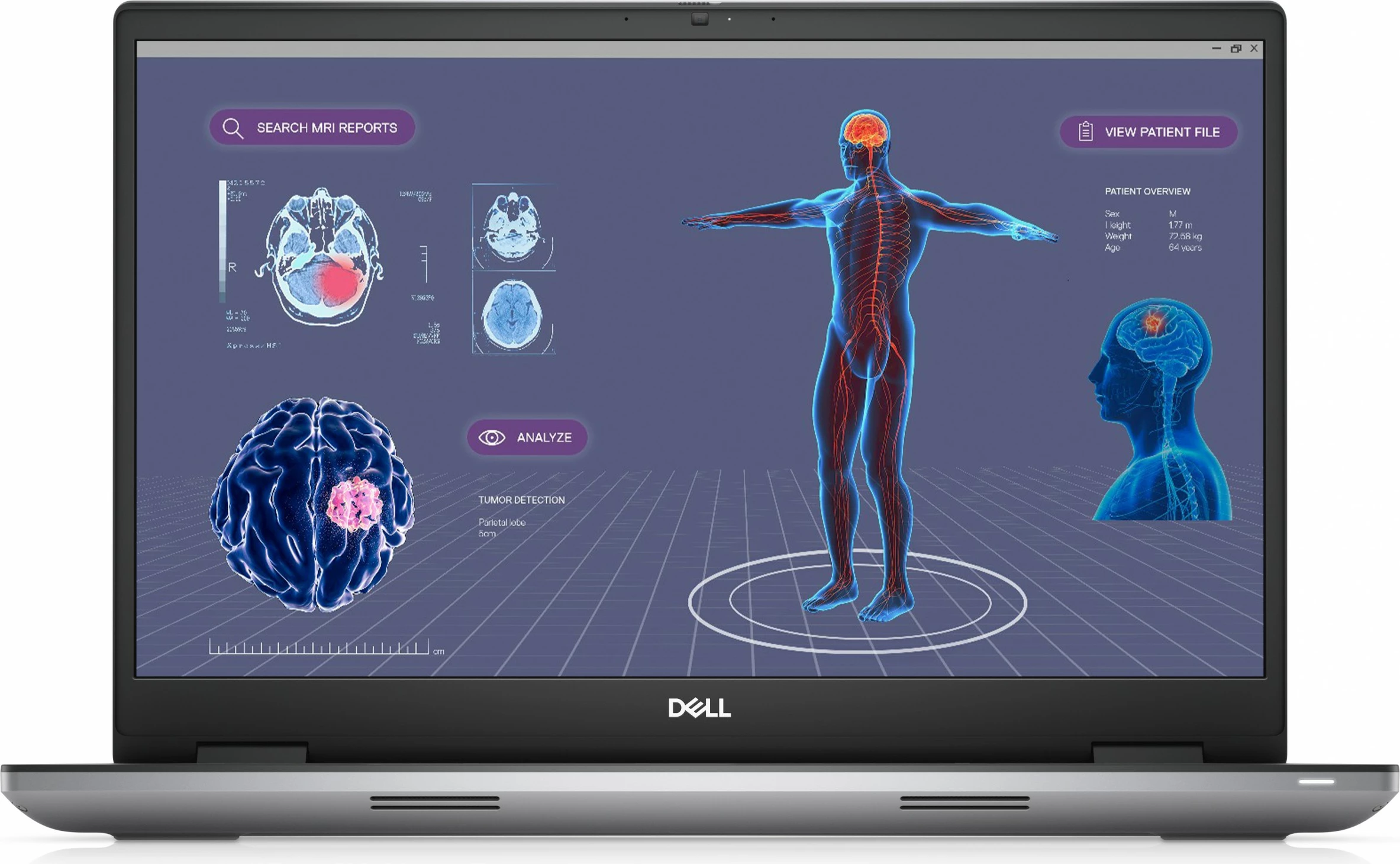 Laptop DELL Precision 7780, Intel Core i7, 32 GB RAM, 1 TB, 17.3", Gri