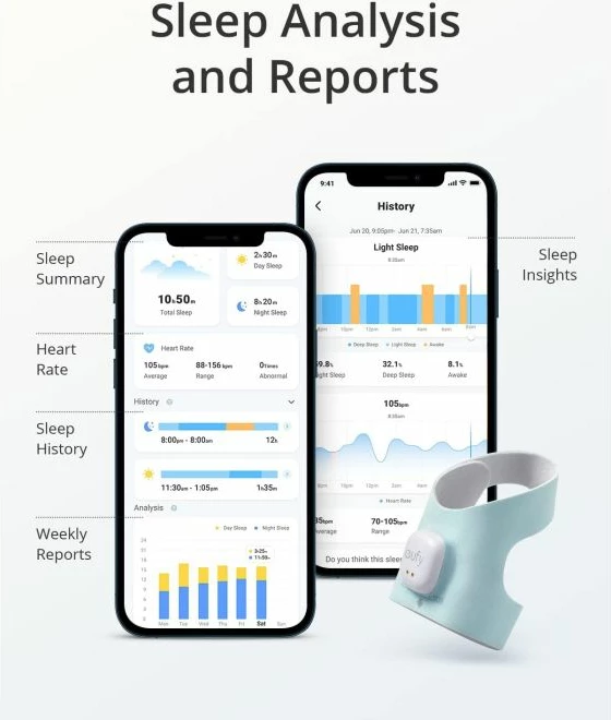 çorape smart monitorimi për bebe + kamerë 2K, Anker Eufy Security Baby S340 (E8340333), monitorim gjumi/ritëm zemre/oksigjen gjaku, njoftime, 0-18 muaj, bardh/mentë
