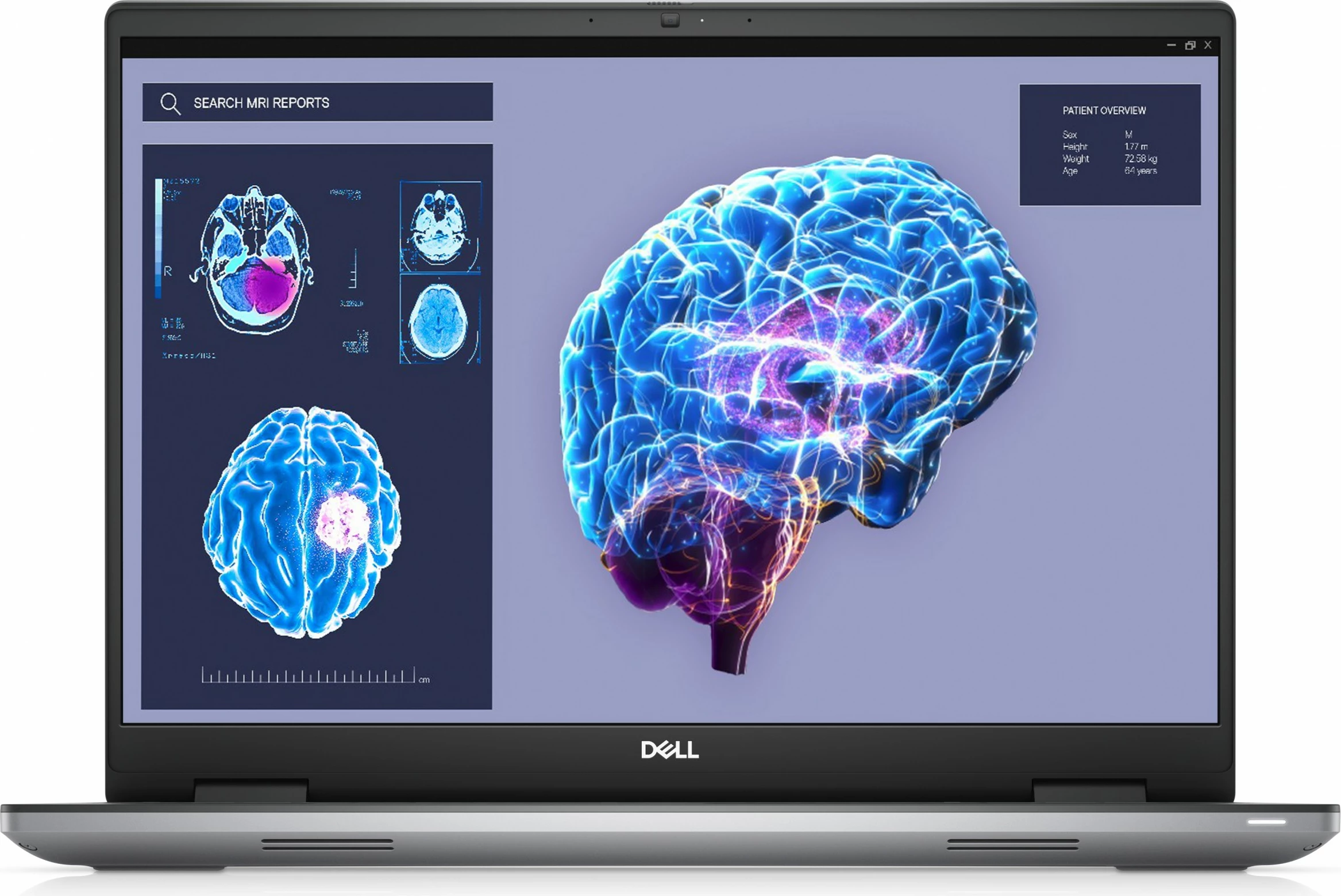 Kompjuter portativ DELL Precision 7680, Intel Core i9, 32GB RAM, 1TB SSD, NVIDIA RTX 3500 Ada, 16 inch